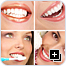 After Cosmetic Dentistry Collage